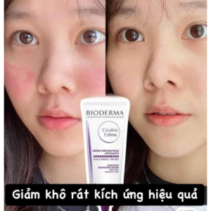 Alternative view of Kem phục hồi da tổn thương và ngăn ngừa sẹo Bioderma Cicabio Crème+ 40ml