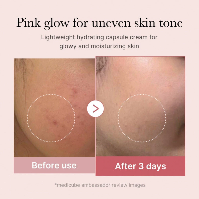 Kem dưỡng dạng viên Medicube TXA + Niacinamide Capsule Cream 5% dưỡng trắng sáng, mờ thâm nám, đều màu da 55g - Ảnh 2